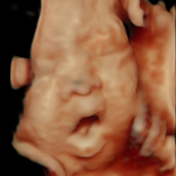 赤ちゃんの3D画像