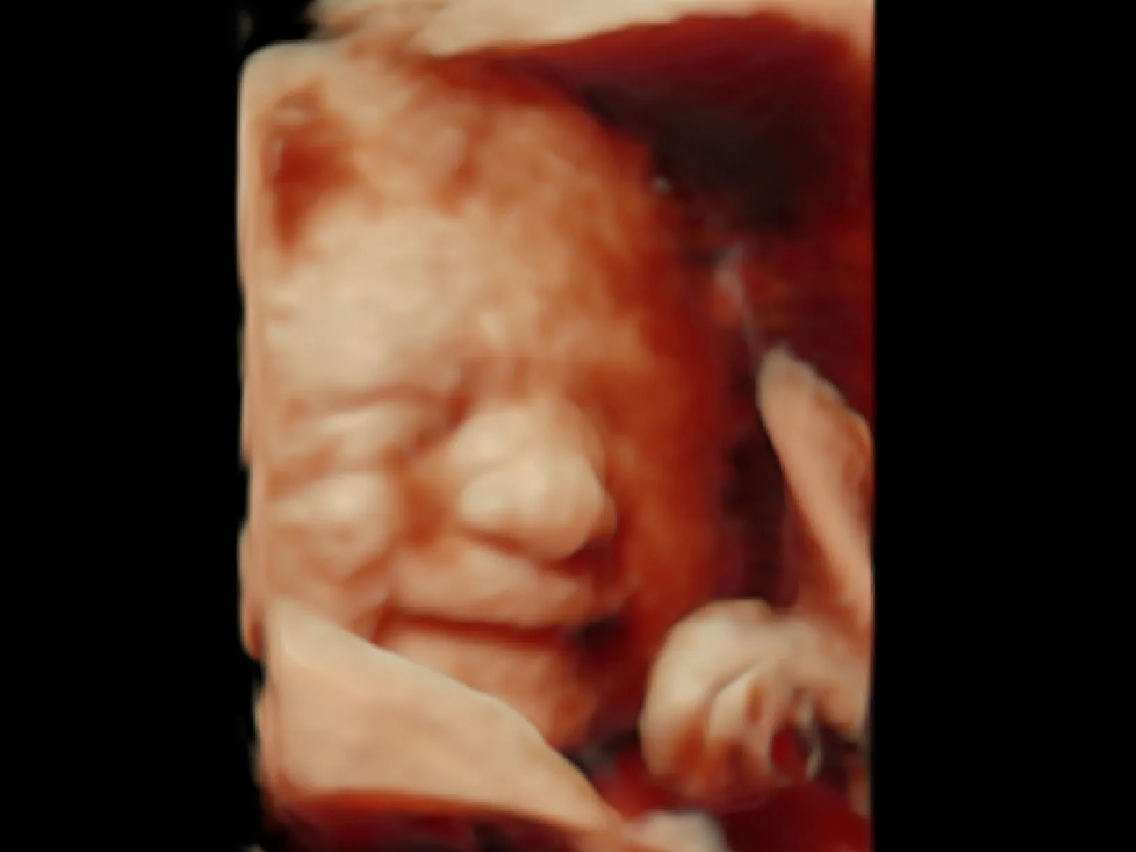 胎児超音波スクリーニング検査による胎児の様子１