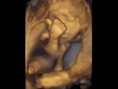 胎児超音波スクリーニング検査による胎児の様子２
