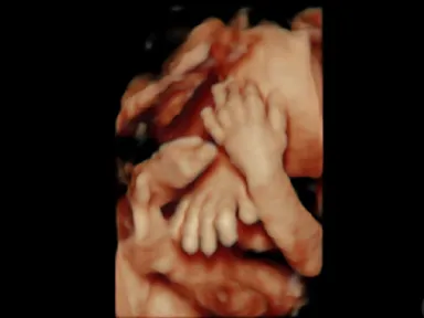 胎児超音波スクリーニング検査による胎児の様子５