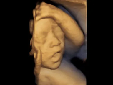 胎児超音波スクリーニング検査による胎児の様子６