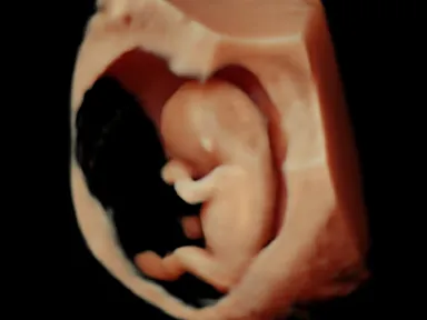 胎児超音波スクリーニング検査による胎児の様子７