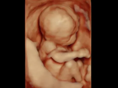 胎児超音波スクリーニング検査による胎児の様子８
